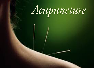 Acupuncture treatment